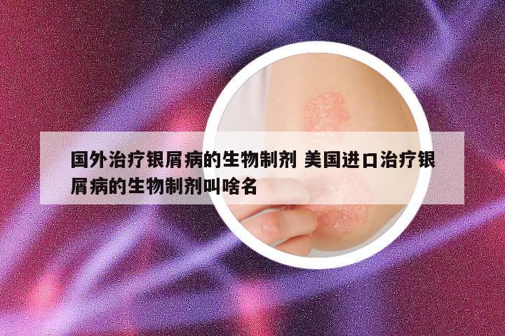 国外治疗银屑病的生物制剂 美国进口治疗银屑病的生物制剂叫啥名