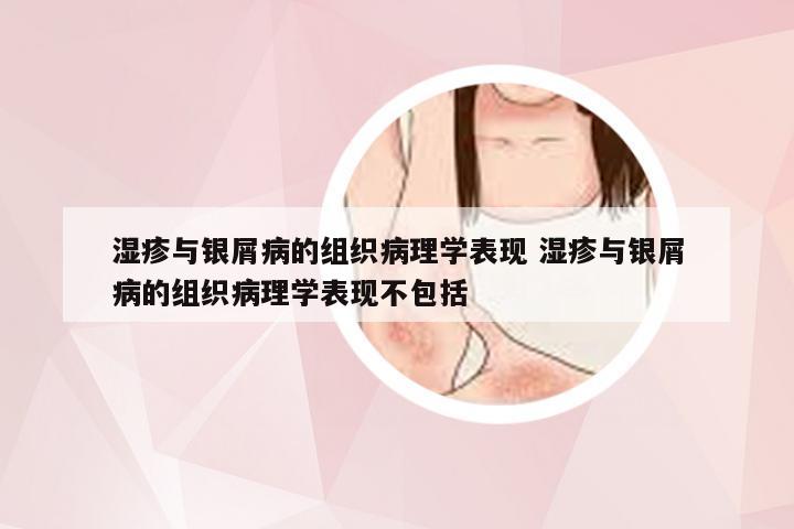 湿疹与银屑病的组织病理学表现 湿疹与银屑病的组织病理学表现不包括