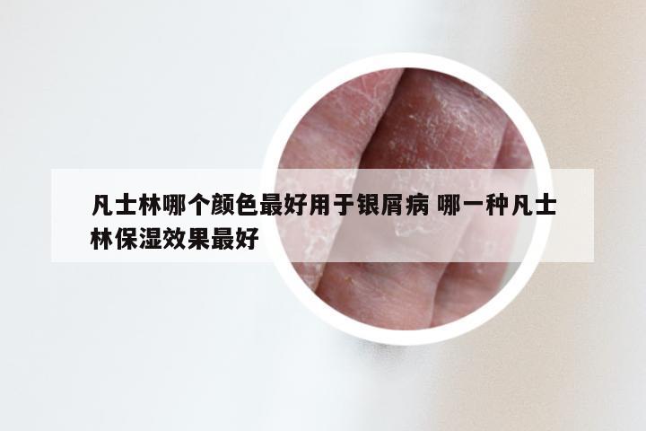 凡士林哪个颜色最好用于银屑病 哪一种凡士林保湿效果最好