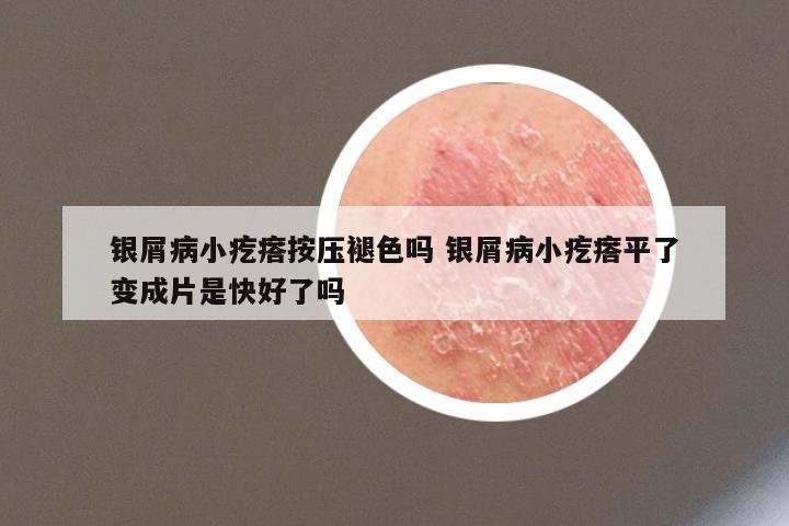 银屑病小疙瘩按压褪色吗 银屑病小疙瘩平了变成片是快好了吗