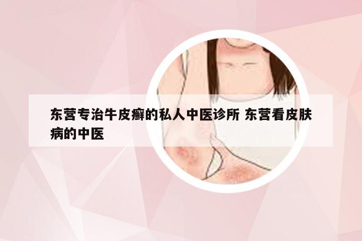 东营专治牛皮癣的私人中医诊所 东营看皮肤病的中医