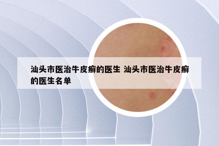 汕头市医治牛皮癣的医生 汕头市医治牛皮癣的医生名单