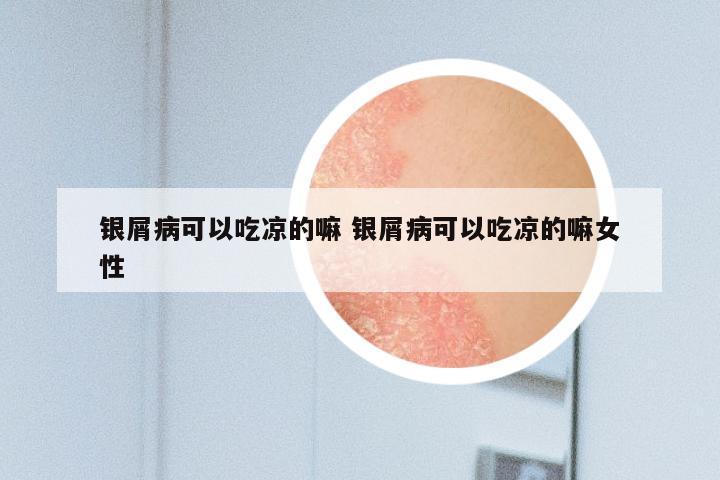 银屑病可以吃凉的嘛 银屑病可以吃凉的嘛女性