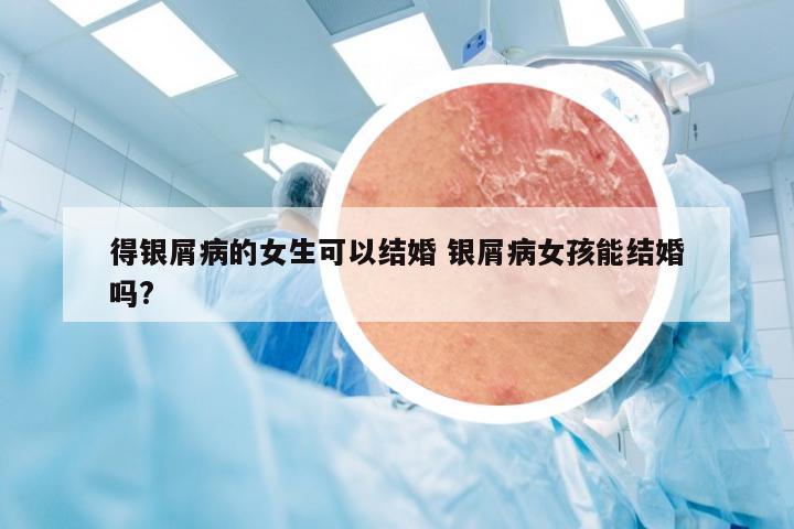 得银屑病的女生可以结婚 银屑病女孩能结婚吗?