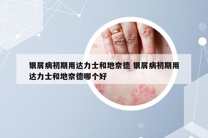 银屑病初期用达力士和地奈德 银屑病初期用达力士和地奈德哪个好