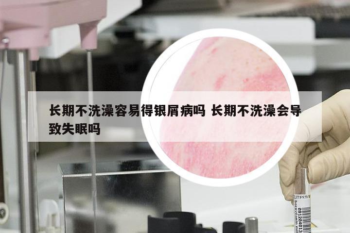 长期不洗澡容易得银屑病吗 长期不洗澡会导致失眠吗