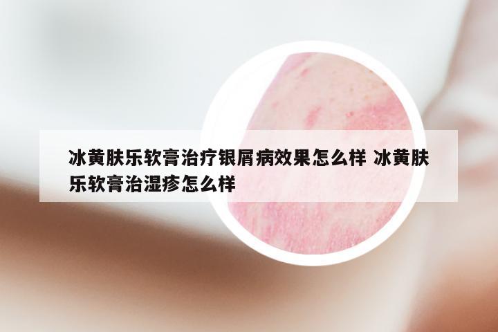 冰黄肤乐软膏治疗银屑病效果怎么样 冰黄肤乐软膏治湿疹怎么样
