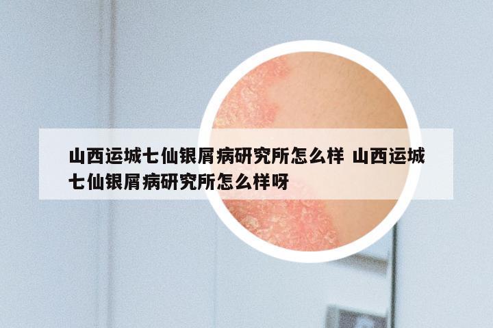 山西运城七仙银屑病研究所怎么样 山西运城七仙银屑病研究所怎么样呀