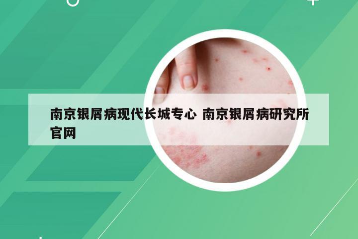 南京银屑病现代长城专心 南京银屑病研究所官网
