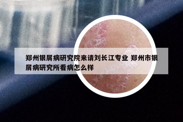 郑州银屑病研究院来请刘长江专业 郑州市银屑病研究所看病怎么样