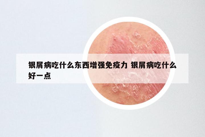 银屑病吃什么东西增强免疫力 银屑病吃什么好一点