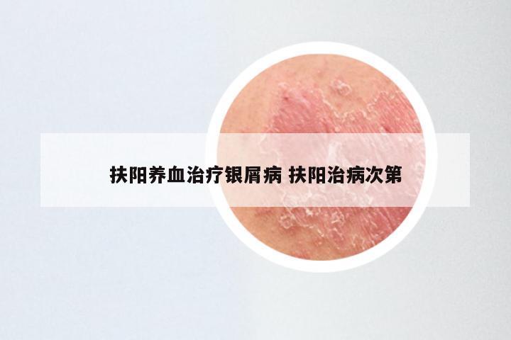 扶阳养血治疗银屑病 扶阳治病次第