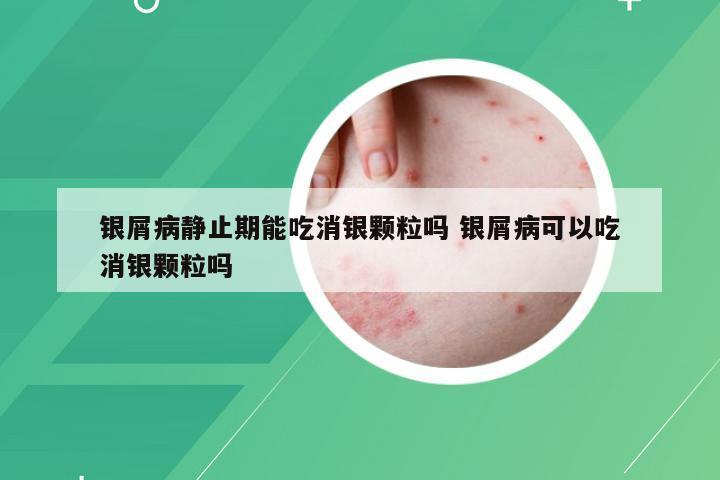 银屑病静止期能吃消银颗粒吗 银屑病可以吃消银颗粒吗