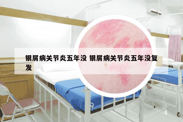银屑病关节炎五年没 银屑病关节炎五年没复发