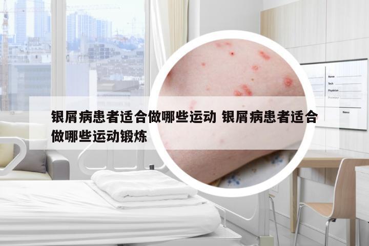 银屑病患者适合做哪些运动 银屑病患者适合做哪些运动锻炼
