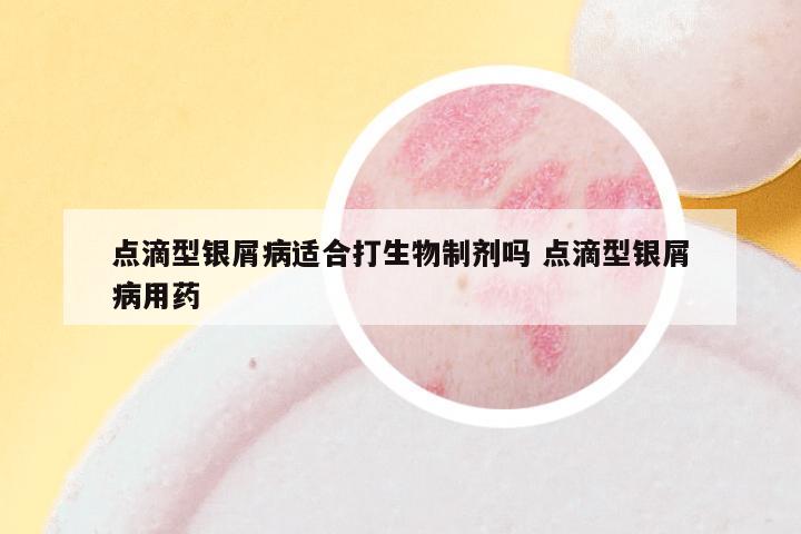点滴型银屑病适合打生物制剂吗 点滴型银屑病用药