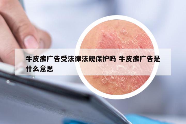 牛皮癣广告受法律法规保护吗 牛皮癣广告是什么意思