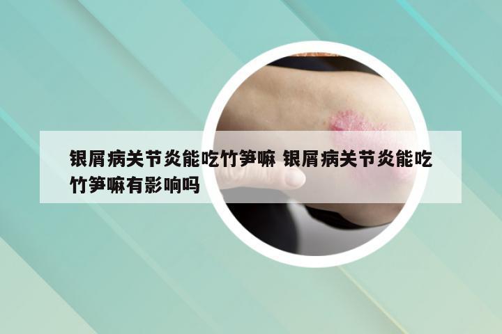银屑病关节炎能吃竹笋嘛 银屑病关节炎能吃竹笋嘛有影响吗