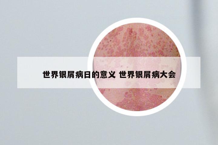 世界银屑病日的意义 世界银屑病大会