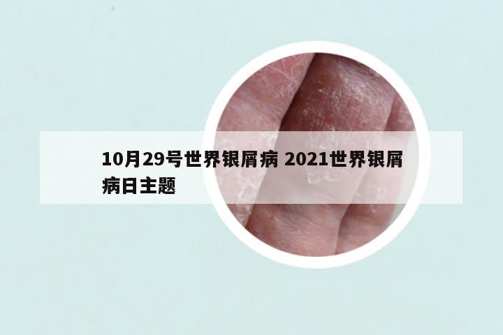 10月29号世界银屑病 2021世界银屑病日主题