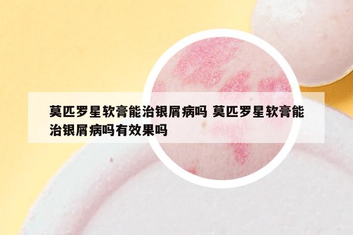 莫匹罗星软膏能治银屑病吗 莫匹罗星软膏能治银屑病吗有效果吗