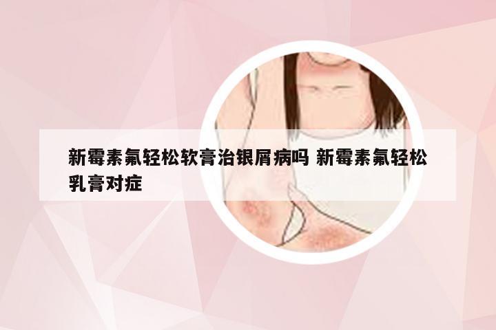 新霉素氟轻松软膏治银屑病吗 新霉素氟轻松乳膏对症