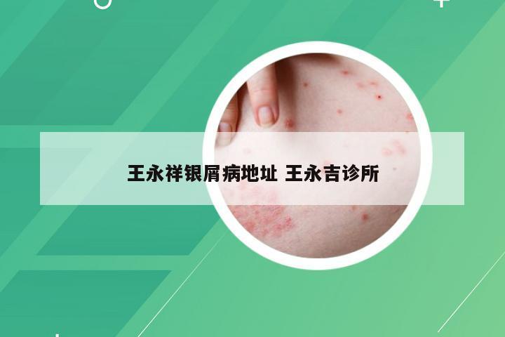王永祥银屑病地址 王永吉诊所