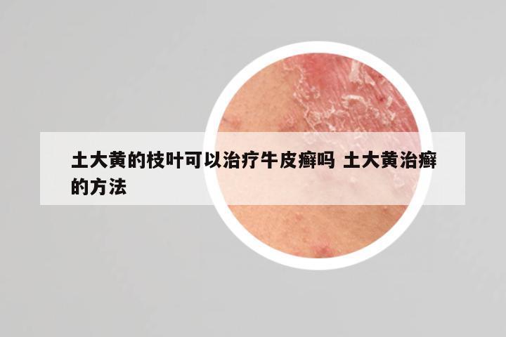 土大黄的枝叶可以治疗牛皮癣吗 土大黄治癣的方法