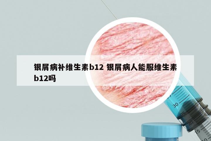 银屑病补维生素b12 银屑病人能服维生素b12吗