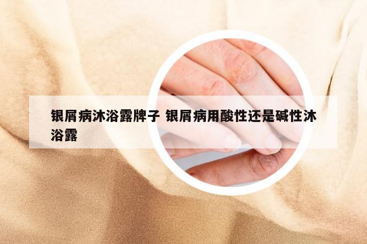 银屑病沐浴露牌子 银屑病用酸性还是碱性沐浴露