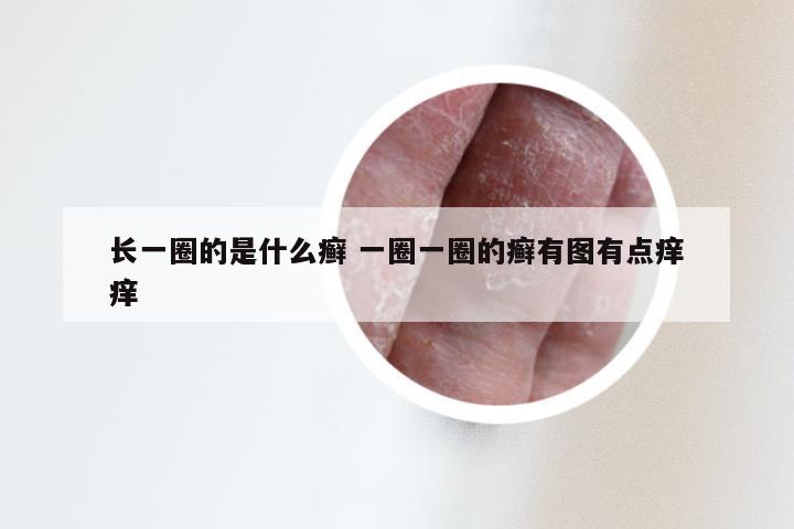 长一圈的是什么癣 一圈一圈的癣有图有点痒痒