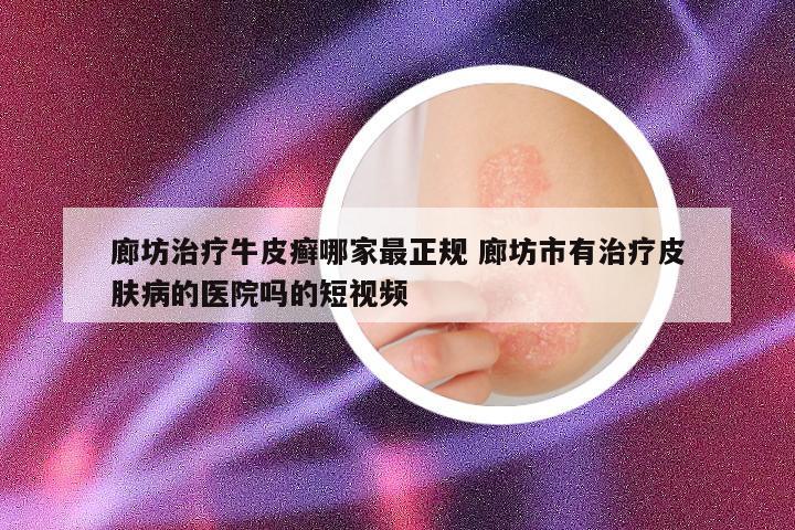 廊坊治疗牛皮癣哪家最正规 廊坊市有治疗皮肤病的医院吗的短视频