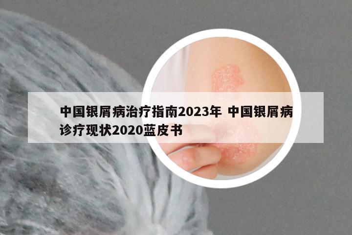中国银屑病治疗指南2023年 中国银屑病诊疗现状2020蓝皮书
