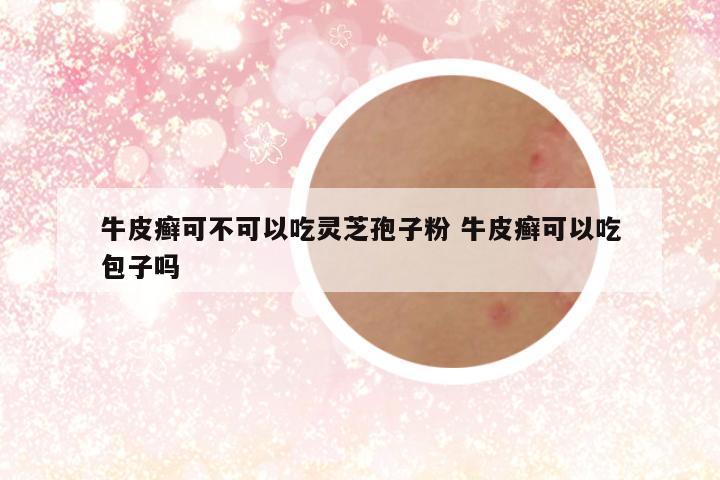 牛皮癣可不可以吃灵芝孢子粉 牛皮癣可以吃包子吗