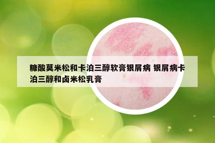 糠酸莫米松和卡泊三醇软膏银屑病 银屑病卡泊三醇和卤米松乳膏
