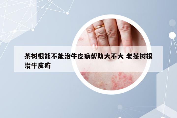 茶树根能不能治牛皮癣帮助大不大 老茶树根治牛皮癣