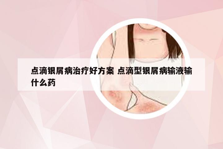 点滴银屑病治疗好方案 点滴型银屑病输液输什么药