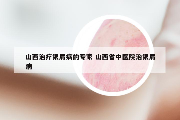 山西治疗银屑病的专家 山西省中医院治银屑病