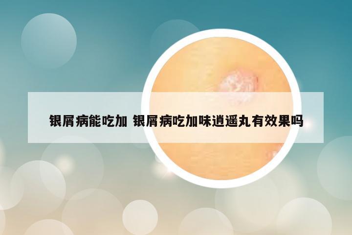 银屑病能吃加 银屑病吃加味逍遥丸有效果吗