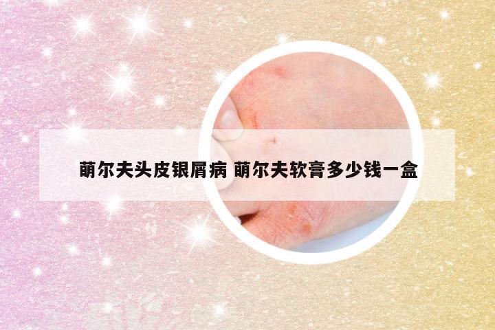 萌尔夫头皮银屑病 萌尔夫软膏多少钱一盒