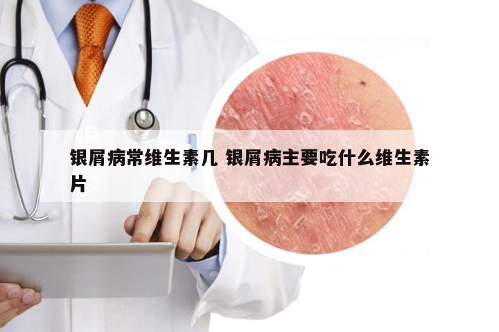 银屑病常维生素几 银屑病主要吃什么维生素片