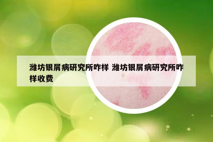 潍坊银屑病研究所咋样 潍坊银屑病研究所咋样收费