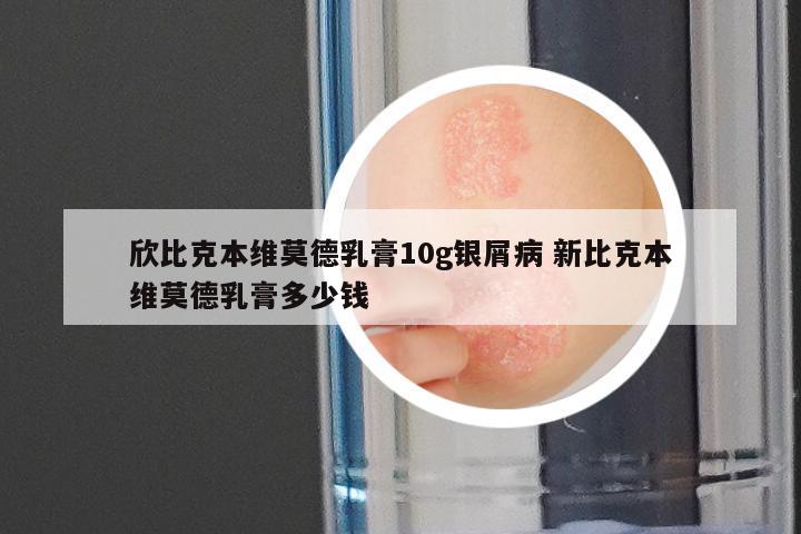 欣比克本维莫德乳膏10g银屑病 新比克本维莫德乳膏多少钱