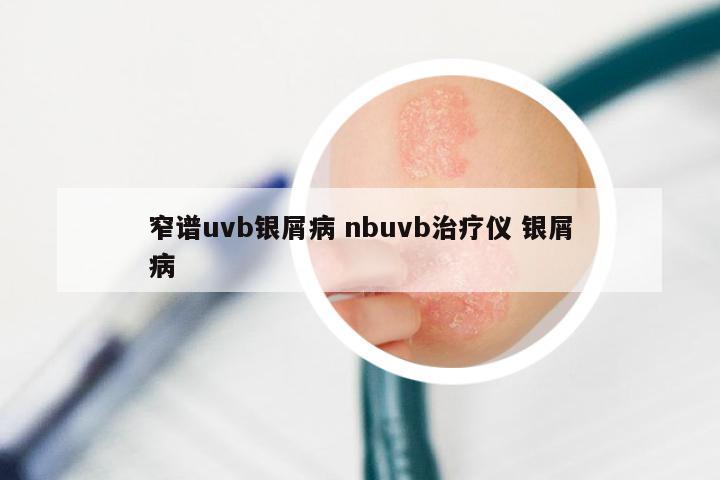窄谱uvb银屑病 nbuvb治疗仪 银屑病