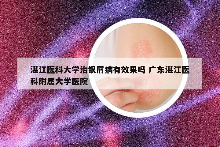 湛江医科大学治银屑病有效果吗 广东湛江医科附属大学医院