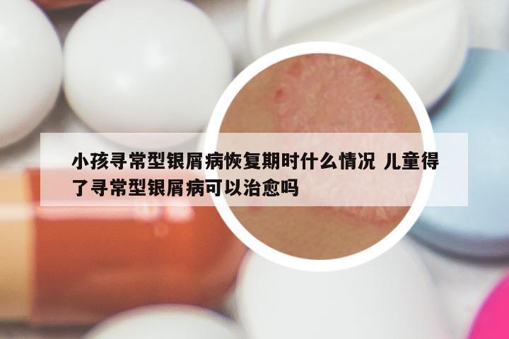 小孩寻常型银屑病恢复期时什么情况 儿童得了寻常型银屑病可以治愈吗