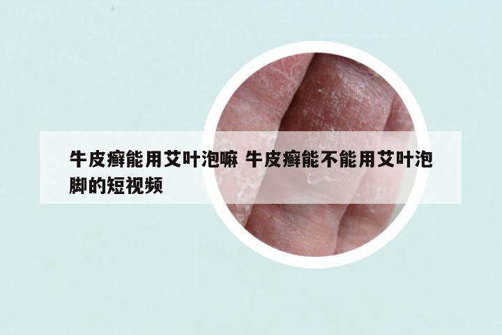 牛皮癣能用艾叶泡嘛 牛皮癣能不能用艾叶泡脚的短视频