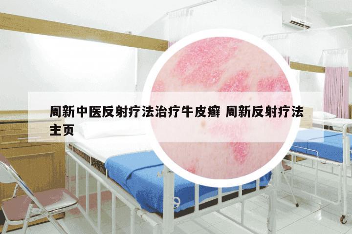 周新中医反射疗法治疗牛皮癣 周新反射疗法主页