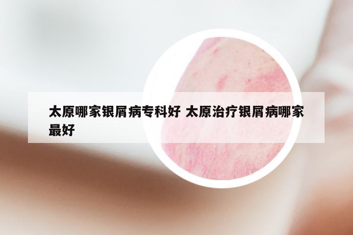 太原哪家银屑病专科好 太原治疗银屑病哪家最好