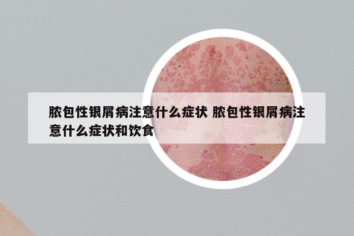 脓包性银屑病注意什么症状 脓包性银屑病注意什么症状和饮食
